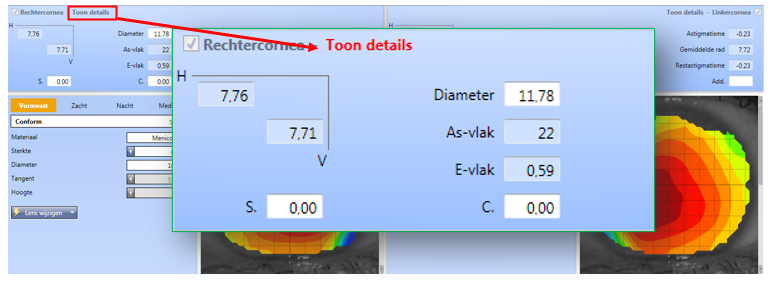 10. toon details