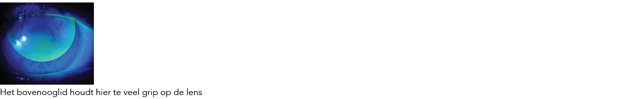 2. Teveel grip
