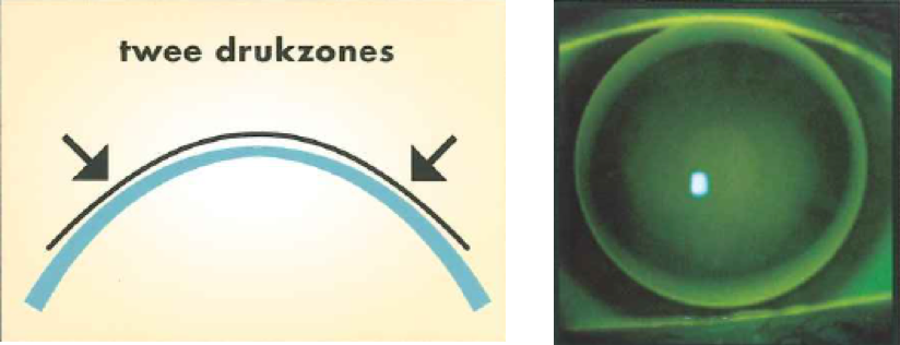 plaatje naast twee drukzones exact